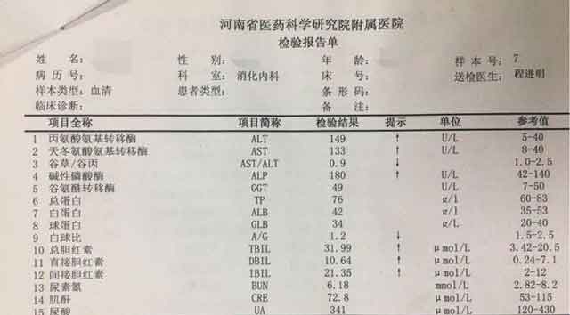 郑州什么医院看肝硬化好?郑州治疗效果好的肝硬化医院