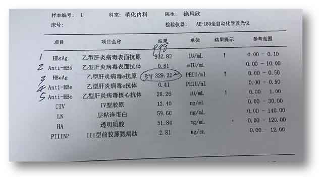 河南肝病好的医院排名?郑州肝病哪个医院看好