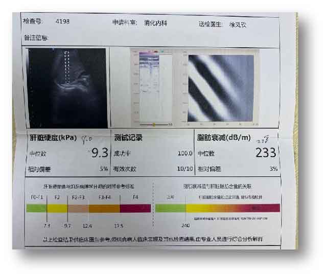 河南肝病好的医院排名?郑州肝病哪个医院看好