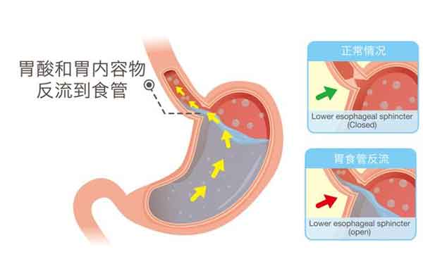 河南省医药院附属医院:拖延治疗,\胃病\变成\老胃病\